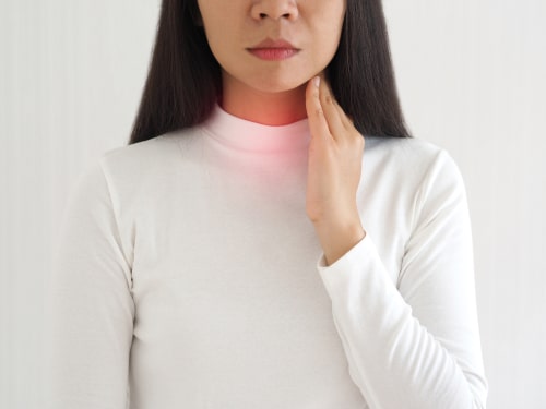 tonsil stones and laryngeal cancer in asian woman.