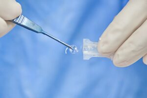 Surgeon holds intraocular lens that replaces a cloudy natural lens affected by cataracts